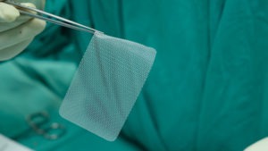 hernia mesh in the OR