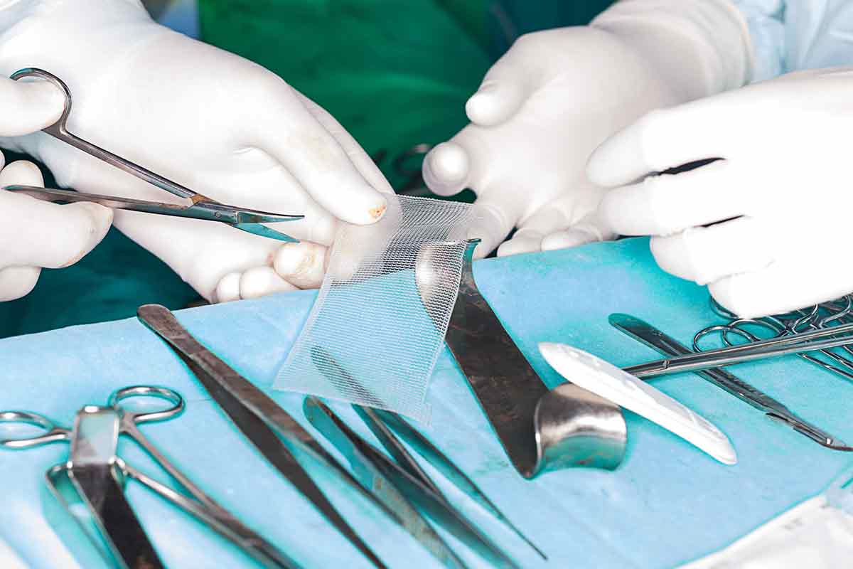 faulty-failed-or-defective-medical-devices-like-hip-implants-transvaginal-mesh-and-more